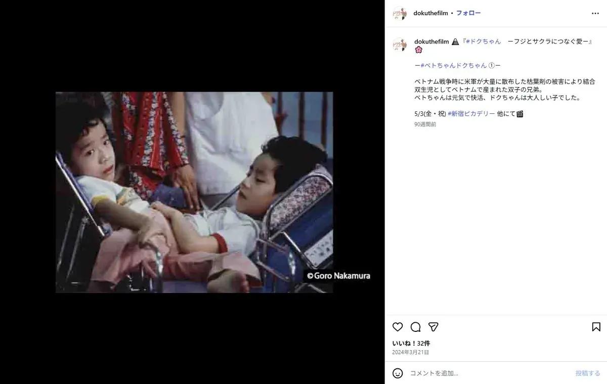 Nguyễn Đức ('Việt - Đức') 37 năm sau phẫu thuật